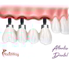 Slider image (9) Atlantis Dental